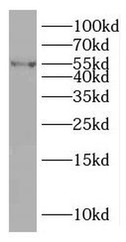 TAB1 Rabbit Polyclonal Antibody