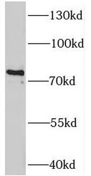 TAB2 Rabbit Polyclonal Antibody
