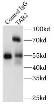 TAB2 Rabbit Polyclonal Antibody