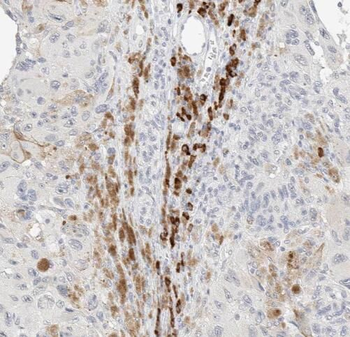 TAB2 Rabbit Polyclonal Antibody