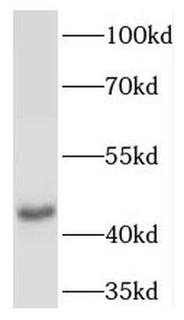 TACR2 Rabbit Polyclonal Antibody