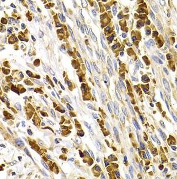 TACR3 Rabbit Polyclonal Antibody