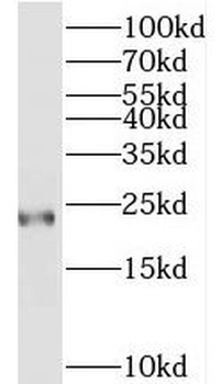 TAGLN3 Rabbit Polyclonal Antibody