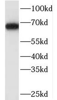 NR2C2 Rabbit Polyclonal Antibody