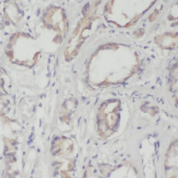 NR2C2 Rabbit Polyclonal Antibody