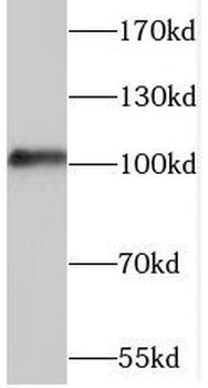TAOK3 Rabbit Polyclonal Antibody