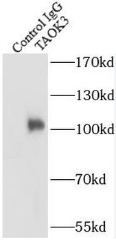 TAOK3 Rabbit Polyclonal Antibody