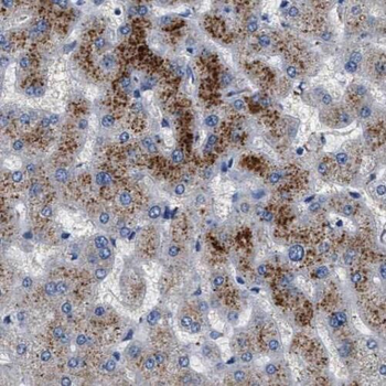 TAOK3 Rabbit Polyclonal Antibody