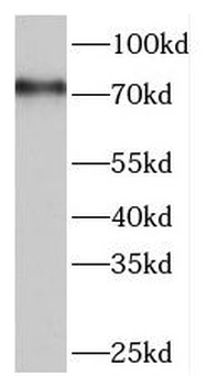 TAP1 Rabbit Polyclonal Antibody