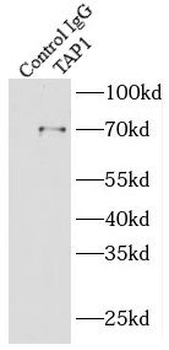 TAP1 Rabbit Polyclonal Antibody