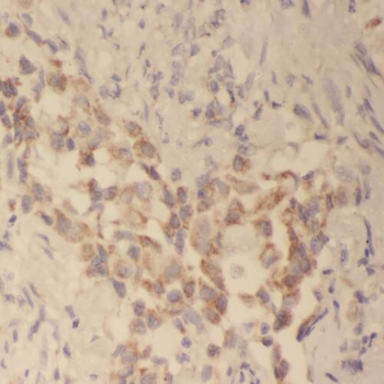 TAP1 Rabbit Polyclonal Antibody