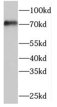 TRIOBP Rabbit Polyclonal Antibody