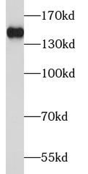 TBC1D1 Rabbit Polyclonal Antibody