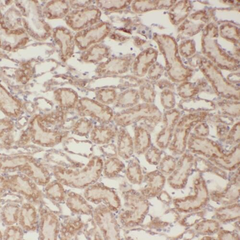 TBC1D1 Rabbit Polyclonal Antibody