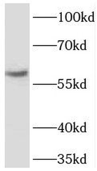 TBL1XR1 Rabbit Polyclonal Antibody