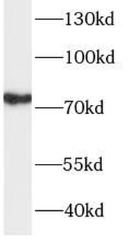 TBR1 Rabbit Polyclonal Antibody