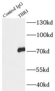 TBR1 Rabbit Polyclonal Antibody