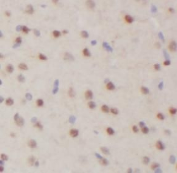 TBR1 Rabbit Polyclonal Antibody