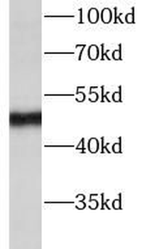 TBRG1 Rabbit Polyclonal Antibody