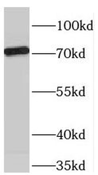 TBX2 Rabbit Polyclonal Antibody