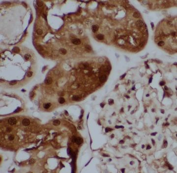 TBX2 Rabbit Polyclonal Antibody