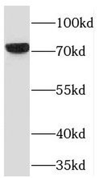 TBX2 Rabbit Polyclonal Antibody