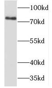 TBX3 Rabbit Polyclonal Antibody
