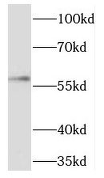 TBX5 Rabbit Polyclonal Antibody