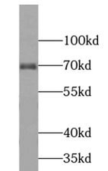 TCF4 Rabbit Polyclonal Antibody
