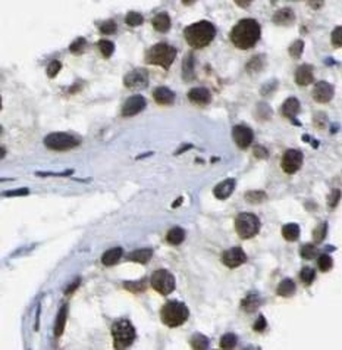 TCF4 Rabbit Polyclonal Antibody