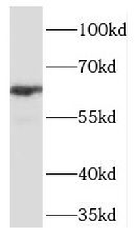 TCF7L1 Rabbit Polyclonal Antibody