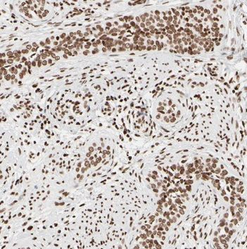TCF7L1 Rabbit Polyclonal Antibody