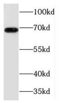 TCF7L2 Rabbit Polyclonal Antibody
