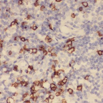 TCL1A Rabbit Polyclonal Antibody