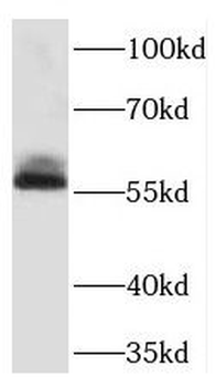TDG Rabbit Polyclonal Antibody
