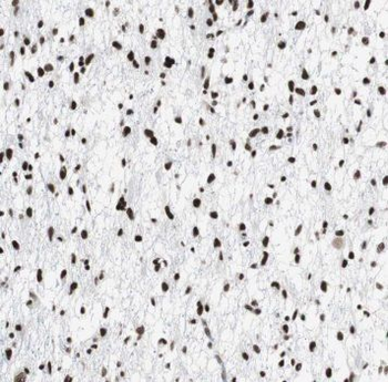 TARDBP Mouse Monoclonal Antibody