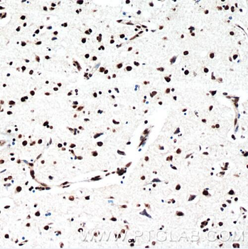 TARDBP Mouse Monoclonal Antibody