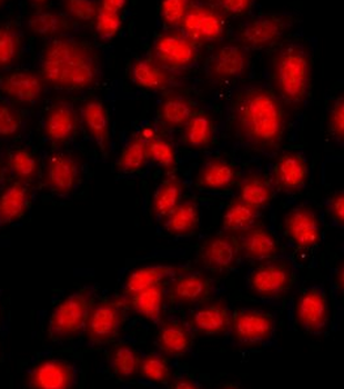 TEAD3 Rabbit Polyclonal Antibody