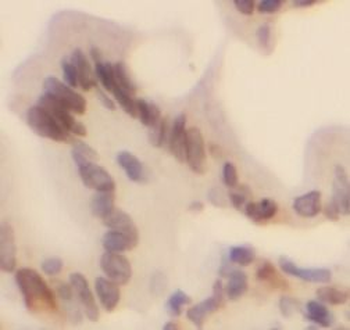 TEAD3 Rabbit Polyclonal Antibody