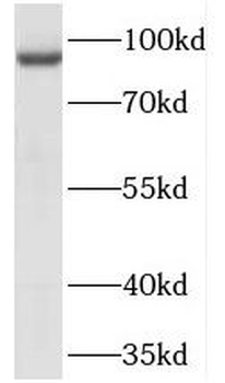 TELO2 Rabbit Polyclonal Antibody