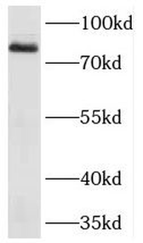CD248 Rabbit Polyclonal Antibody