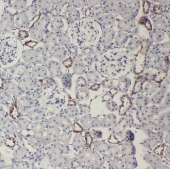CD248 Rabbit Polyclonal Antibody