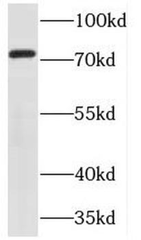 TNXB Rabbit Polyclonal Antibody