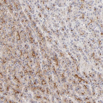 TNXB Rabbit Polyclonal Antibody