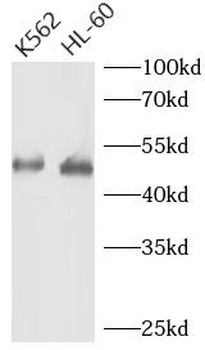 TERF1 Rabbit Polyclonal Antibody
