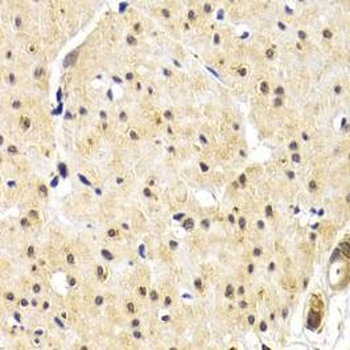TERF1 Rabbit Polyclonal Antibody