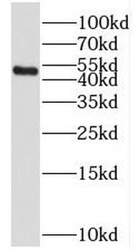 TFB2M Rabbit Polyclonal Antibody