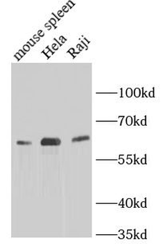 TFEB Rabbit Polyclonal Antibody