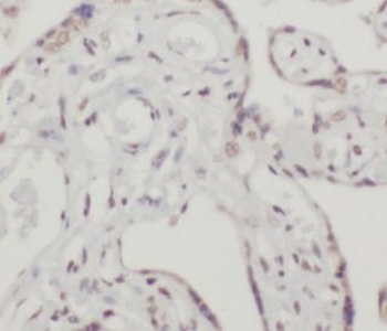 TFEB Rabbit Polyclonal Antibody