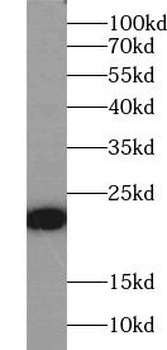 TFF2 Rabbit Polyclonal Antibody